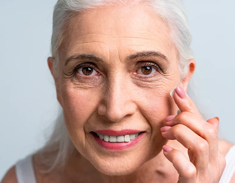 arrugas-periorbital
